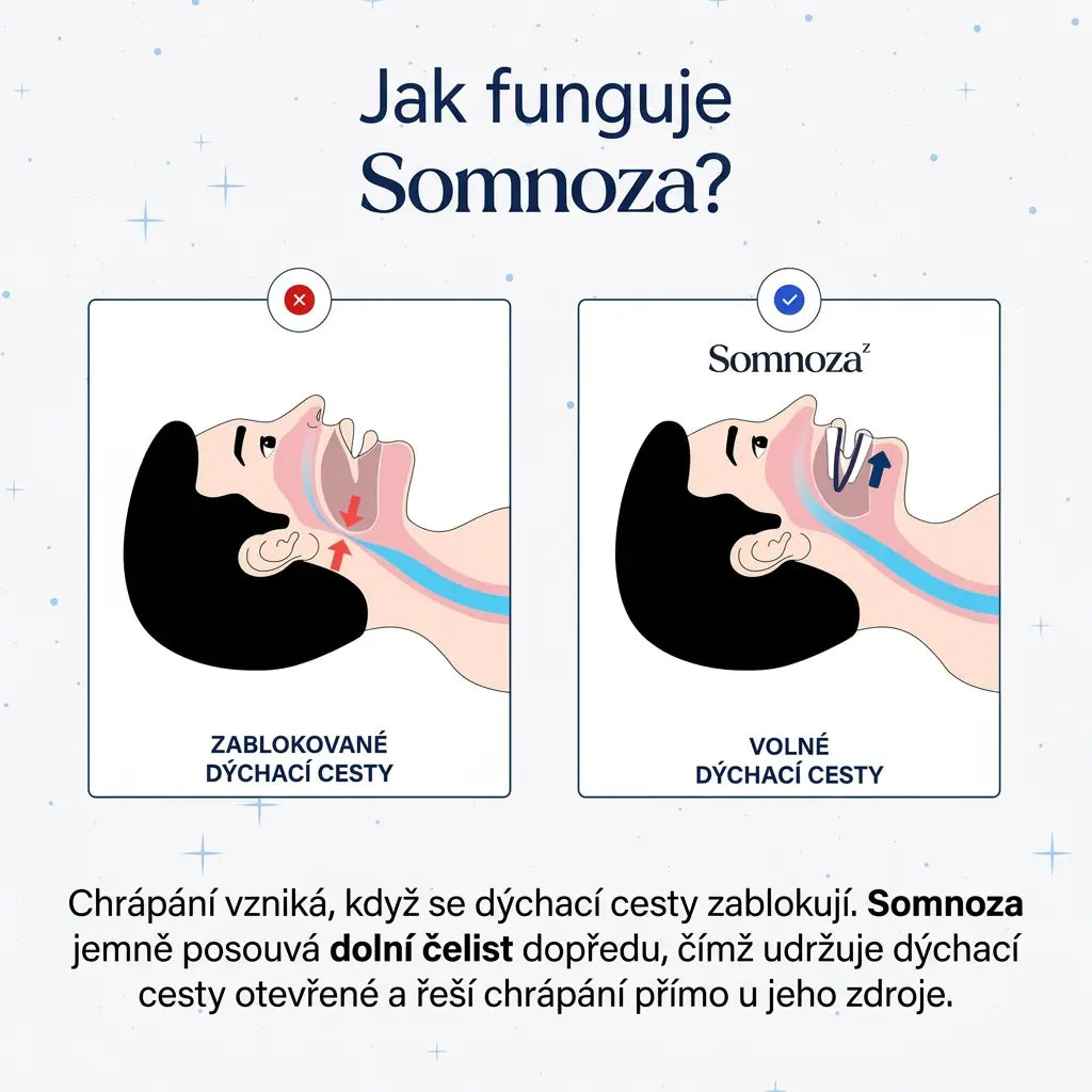 Náustek proti chrápání